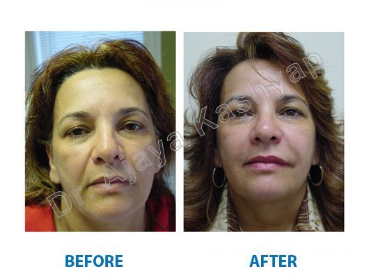 non surgical treatment in aya nagar